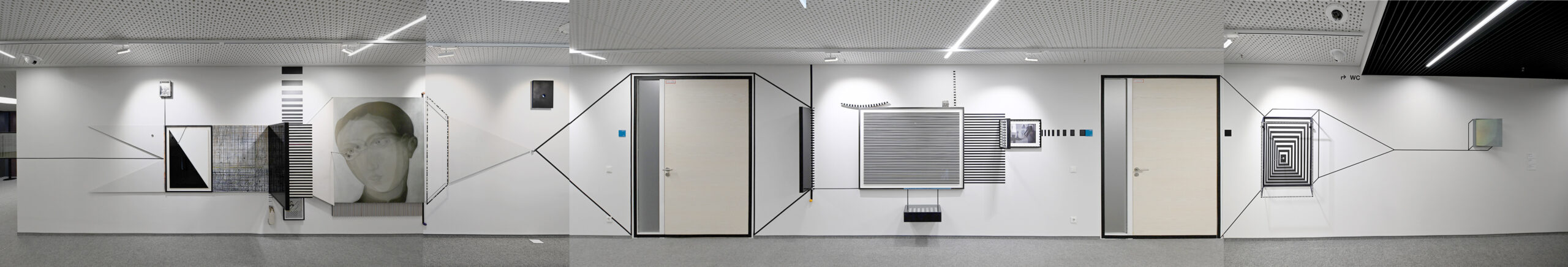 cerebal vantage points